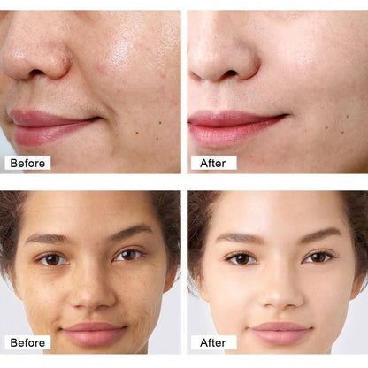 Retinol Anti Aging Face Cream & Face Serum (Pack Of 1) 50g